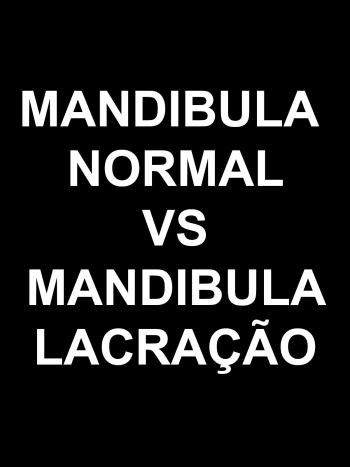 Mandibula normal vs Mandibula lacra&ccedil;&atilde;o